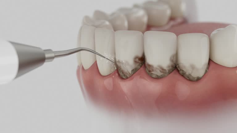 Reliable Teeth Cleaning And Checkup contractor in Scott County County, IA by Dentist Open Now